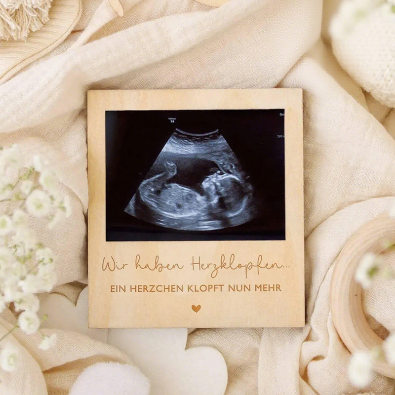 Ultrasound Pregnancy Announcem - Engraved Wood Frame 评论和价格